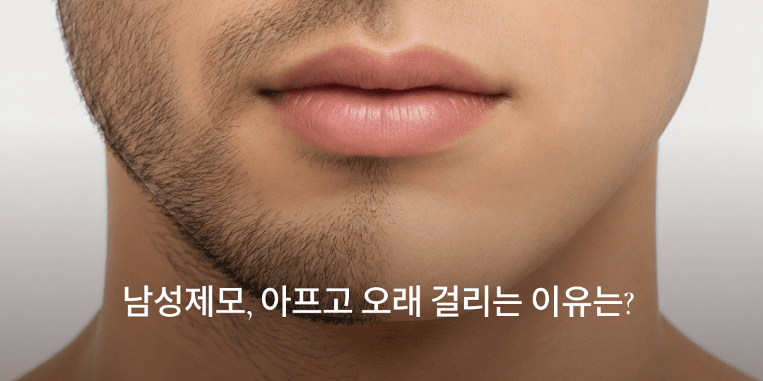 Men's laser hair removal: why it hurts and takes longer